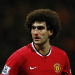 Manchester United's Marouane Fellaini with bloody nose Football - Preston North End v Manchester United - FA Cup Fifth Round - Deepdale - 16/2/15    REUTERS/Phil Noble  Livepic  EDITORIAL USE ONLY. No use with unauthorized audio, video, data, fixture lists, club/league logos or "live" services. Online in-match use limited to 45 images, no video emulation. No use in betting, games or single club/league/player publications.  Please contact your account representative for further details.
